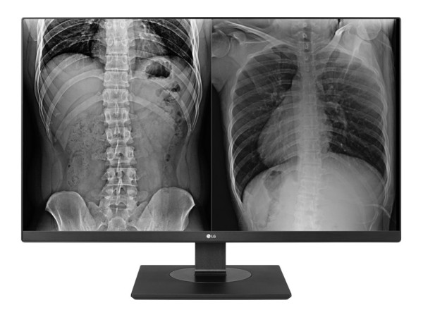 LG 27HJ713C-B 68,58cm (27") 27HJ713C-B