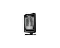 REIN MEDICAL MEDIGENIC MSS300 54,1cm (21,3")